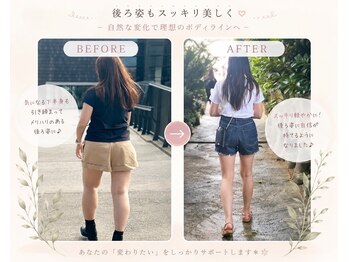 ヨサパーク ミュウ ヨシムラテン(YOSA PARK MIU)/ビフォーアフター