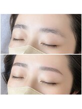 スムーピー(Smoopy)/ガタガタ下がり眉を改善！/眉毛