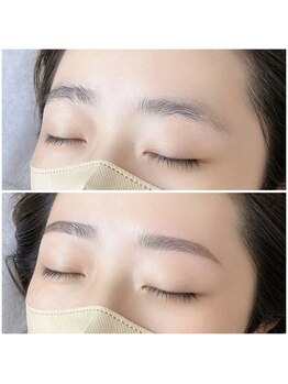 スムーピー(Smoopy)/ガタガタ下がり眉を改善！/眉毛