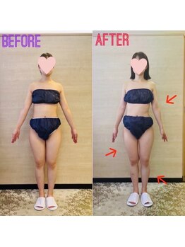 エステティックサロン アール 大阪梅田(esthetic salon R)/20代女性　前