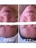 エステ内容13工程で満足感アドバンスコース（すっきりタイプ）100分¥3300 