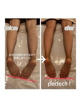 メルシートータルビューティー(MERCI)/足むくみケアに絶対オイルリンパ