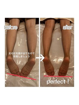 メルシートータルビューティー(MERCI)/足むくみケアに絶対オイルリンパ