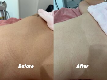 クイーン 渋谷店(QUEEN)/オフショルを着る際も