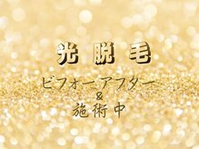 CDF 赤坂/光脱毛