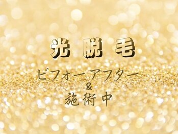 CDF 赤坂/光脱毛