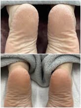 テソロ(Tesoro.)/フットケア