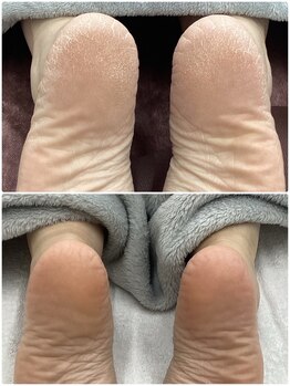 テソロ(Tesoro.)/フットケア