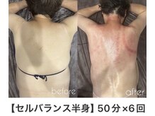 アーネスト 江坂店(EARNEST)/首肩こりケアまで叶える