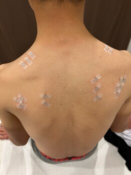 まつもと施療院/特殊施術　施術風景