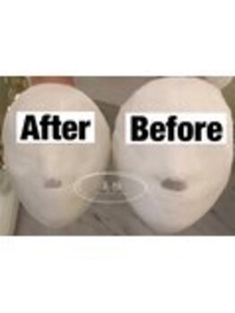 美極 銀座店/銀座/小顔コルギ/小顔矯正