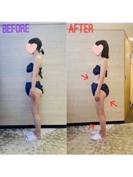 エステティックサロン アール 大阪梅田(esthetic salon R)/20代女性　横