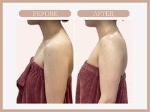 スリムライン 仙台店(The Slim Line)/before→after