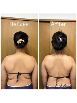 ハニー(Honey82)/全身リンパ+コルギ 比較写真