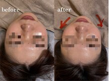 エネ ラッシュアンドブロウ バイ アンドエラ(ENNE Lash&Blow by&ERA)/小顔整体