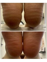 テソロ(Tesoro.)/フットケア