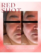 ベル(BELLE)/レッドショット スペシャル２cc