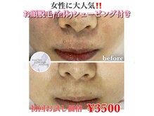 リノア 心斎橋店(LINOAH)/お顔脱毛（シェービング付き)