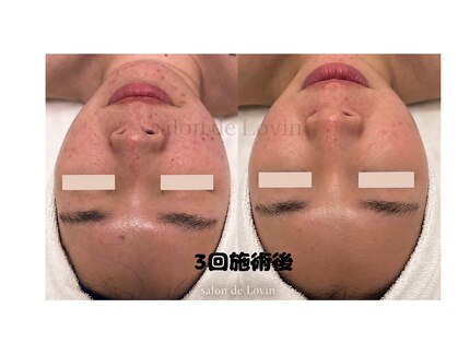 サロンドラヴィン(salon de Lovin)の写真