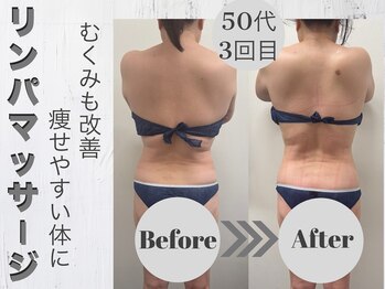 ルーナ(LUNA)/むくみとるだけでスッキリ♪