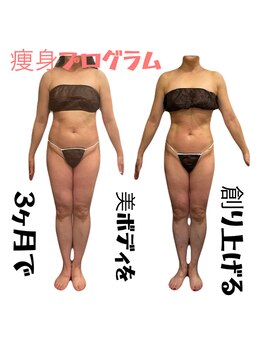 アールユー ギンザ(Ryou ginza)/短期集中結果重視!-5センチ