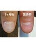 ¥9500【ご新規様メンズ深爪改善】 ウェットケア+フィルイン*クリア