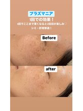 ビューティーネイル(Beauty Nail)/プラズマニア