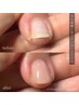 【美爪育成】2枚爪・ちび爪・縦すじ+自爪風ジェルコーティング