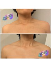 バーン 長崎 諫早(BURN)/ハイパーナイフカット出し