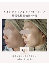 サロンドコーデ(salon de co-de)/エイジングリフト&ピーリング