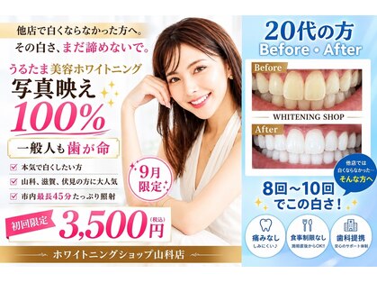 ホワイトニングショップ 山科店の写真