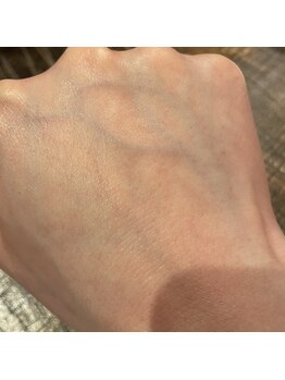 ナノハナ/鹿沼市の全身脱毛美容室ナノハナ