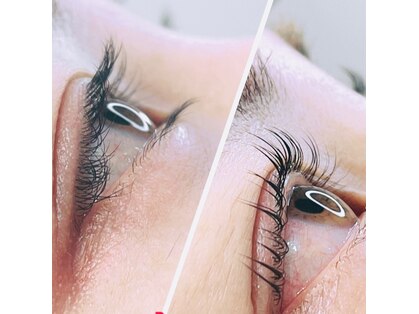 パス アイ(PATH eye)の写真