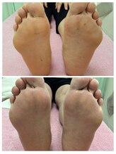 ナカザワ(NAKAZAWA)/足が変わると体調も良くなります