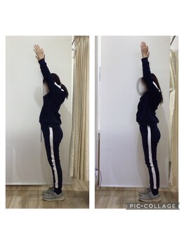 はぴねす鍼灸整骨院 玉造院/姿勢矯正