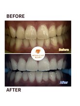 ホワイトニングセンター 谷山店/ホワイトニング/鹿児島