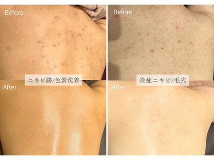 シューラディアント(ShuRadiant)の写真