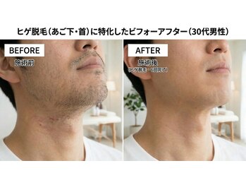 ビイピイジェイズ 大森店(BPJ'S)の写真/脱毛デビューの男性必見★美容室でこっそり男磨き！安心の完全都度払い制