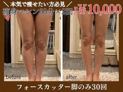 ジーニー(Genie)の写真