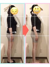 なぎさ整骨院/産後骨盤矯正5回目