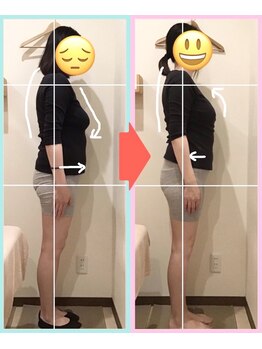 なぎさ整骨院/産後骨盤矯正5回目