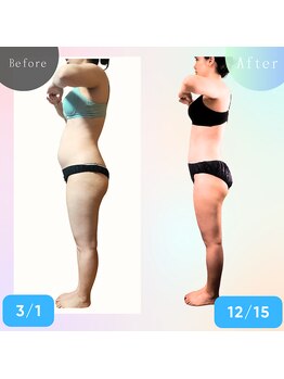 ナチュラルボディラボ 草津店/9ヶ月でお腹スッキリ痩せ!