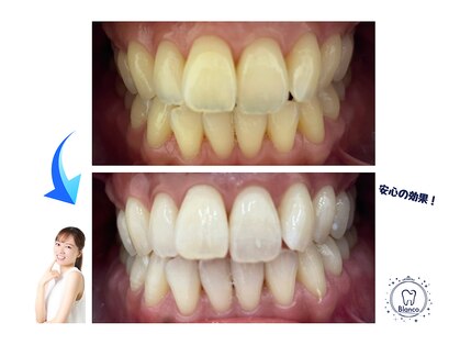 ブランコ 赤羽店(Blanco)の写真