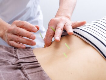 鍼灸マッサージ治療院 巡気堂/≪お試し鍼灸¥3,000≫