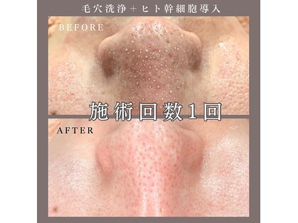 ベルミー(Bellmi)の写真