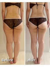 ヒールプラス(heal+)/脚集中コース