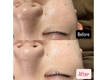 ハイコガオ(HIKOGAO)/ララピール