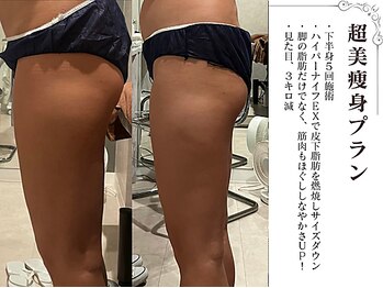 ラブミー 渋谷本店(LoveMe)/骨盤/下半身痩せ/痩身/渋谷/青山