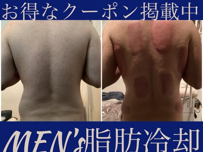 クローネ(Krone)の写真