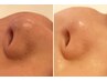 ★NEW【毛穴革命】角栓、毛穴の詰まり、ザラツキを一気に解消（５０分）